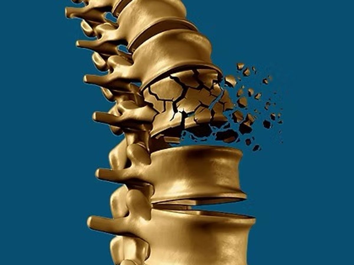 Imagem ilustrativa sobre Saúde óssea